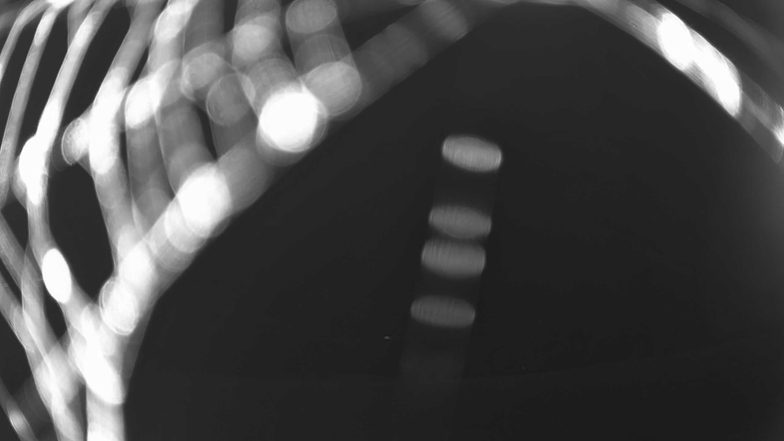 Archiv Foto Webcam Neureichenau