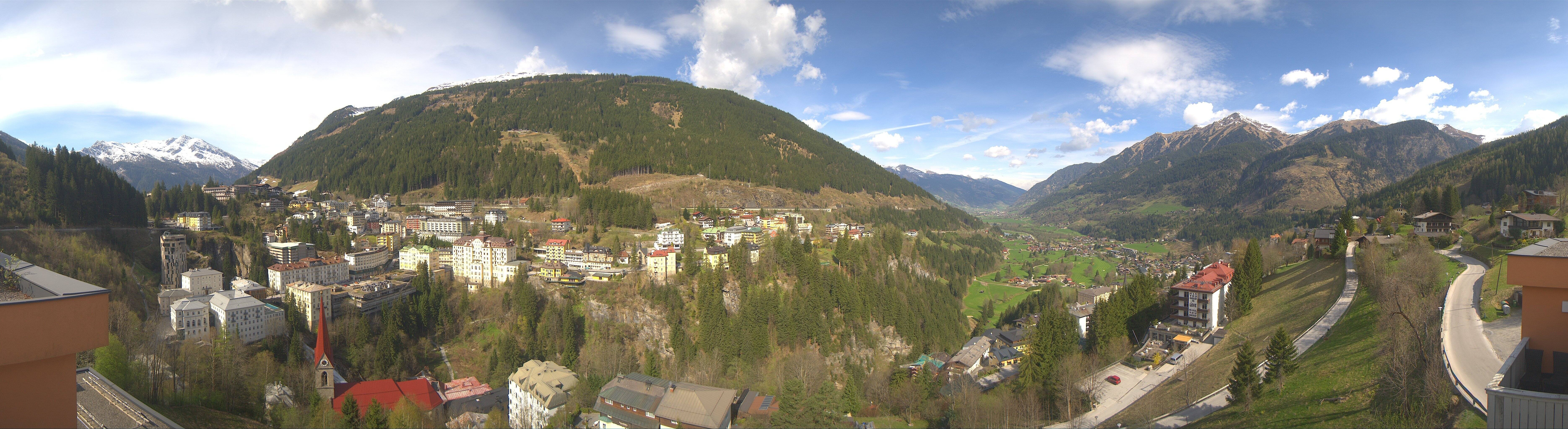 Archived image Webcam Hotel Schillerhof in Bad Gastein
