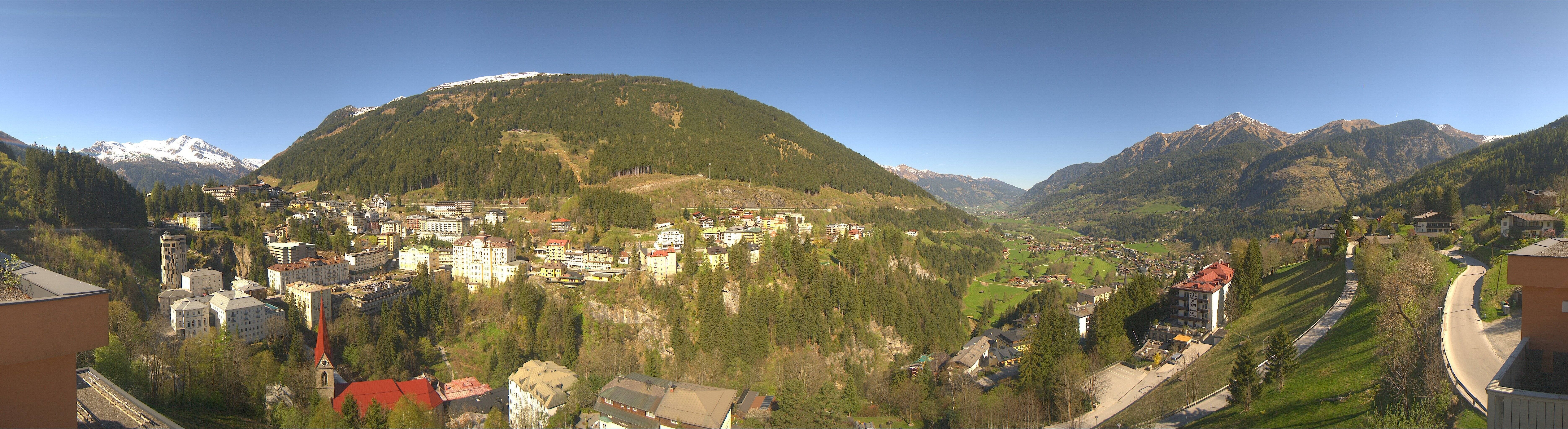 Archived image Webcam Hotel Schillerhof in Bad Gastein