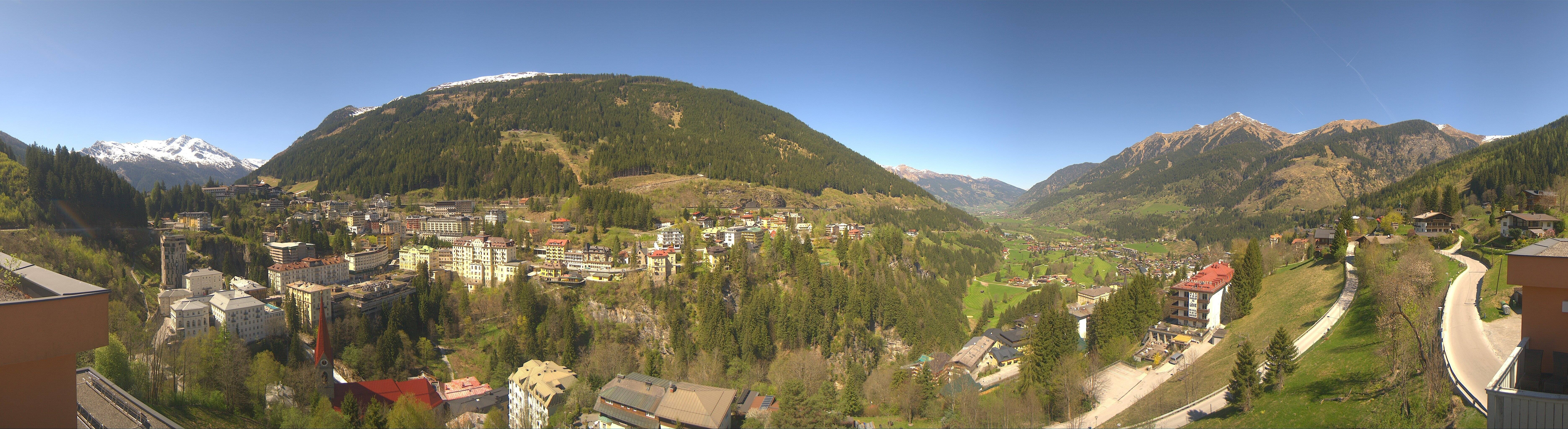 Archived image Webcam Hotel Schillerhof in Bad Gastein