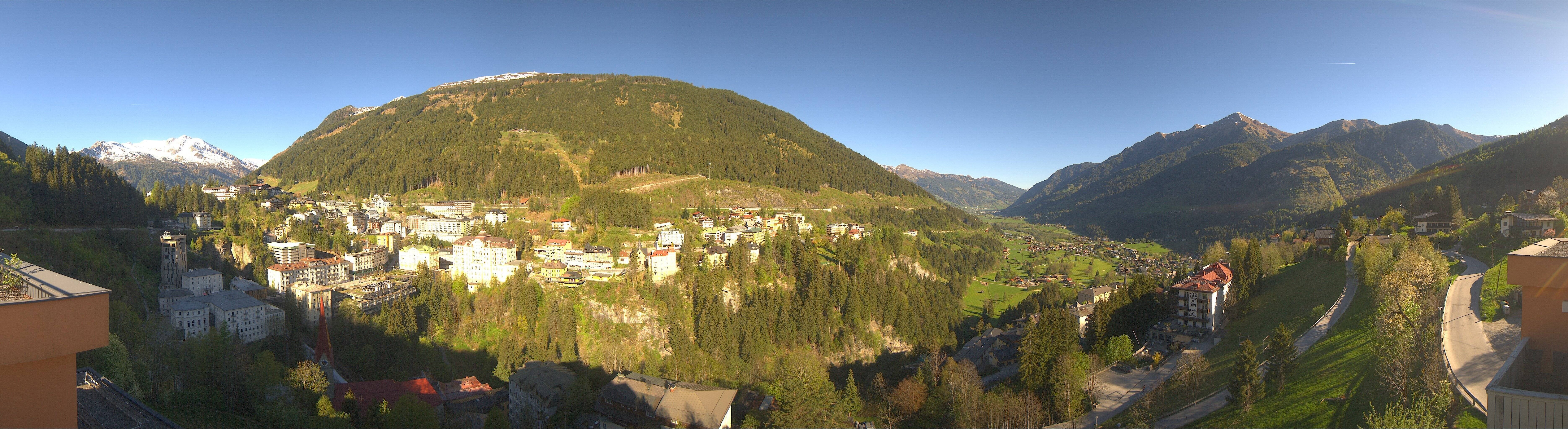 Archived image Webcam Hotel Schillerhof in Bad Gastein