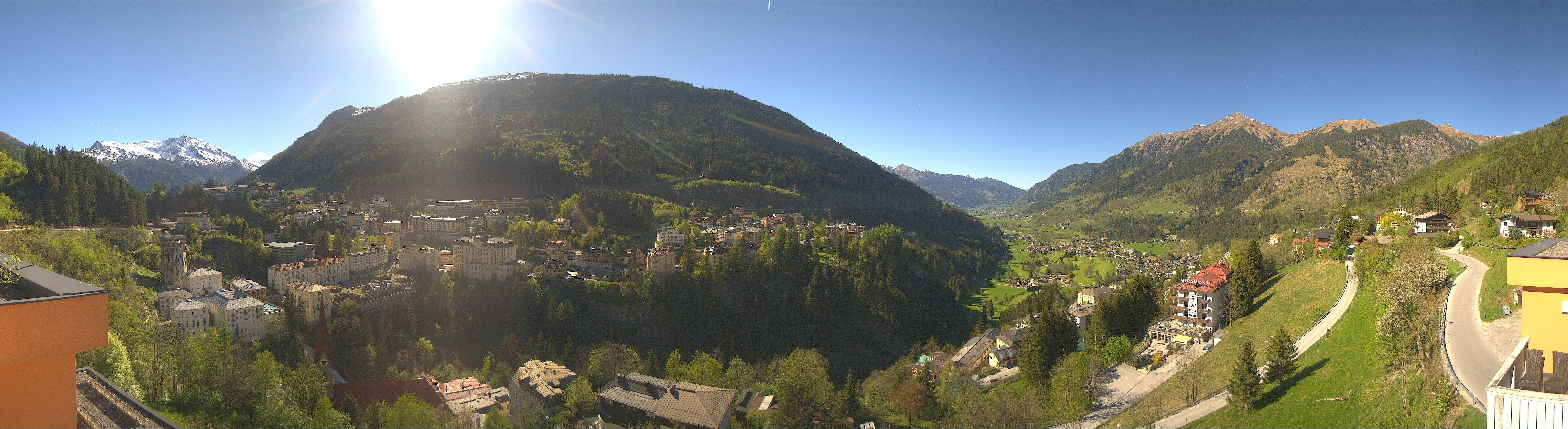 Archived image Webcam Hotel Schillerhof in Bad Gastein
