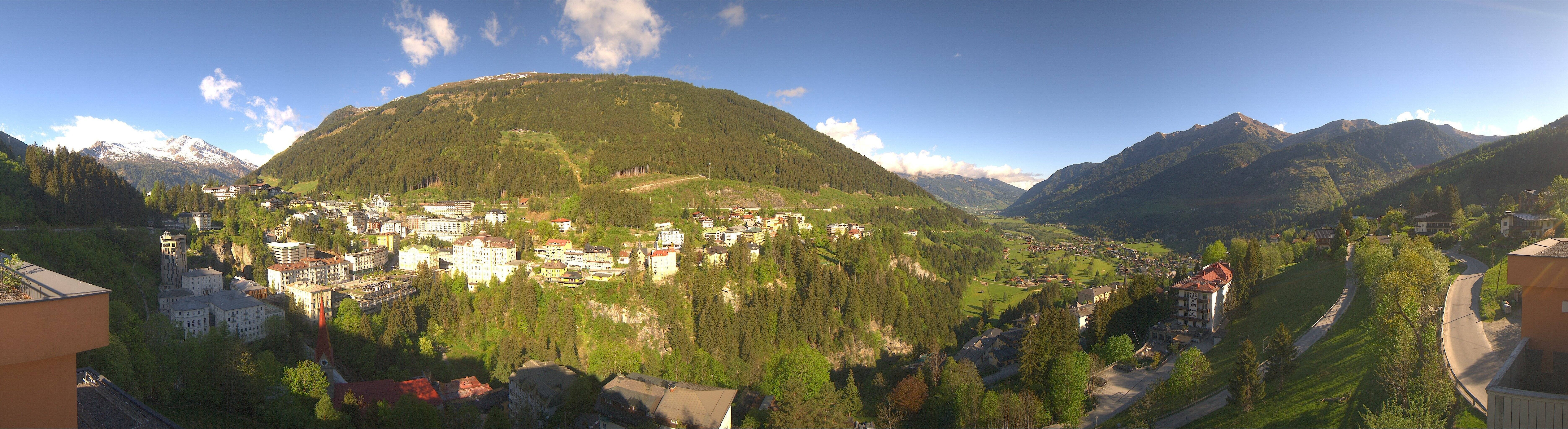 Archived image Webcam Hotel Schillerhof in Bad Gastein