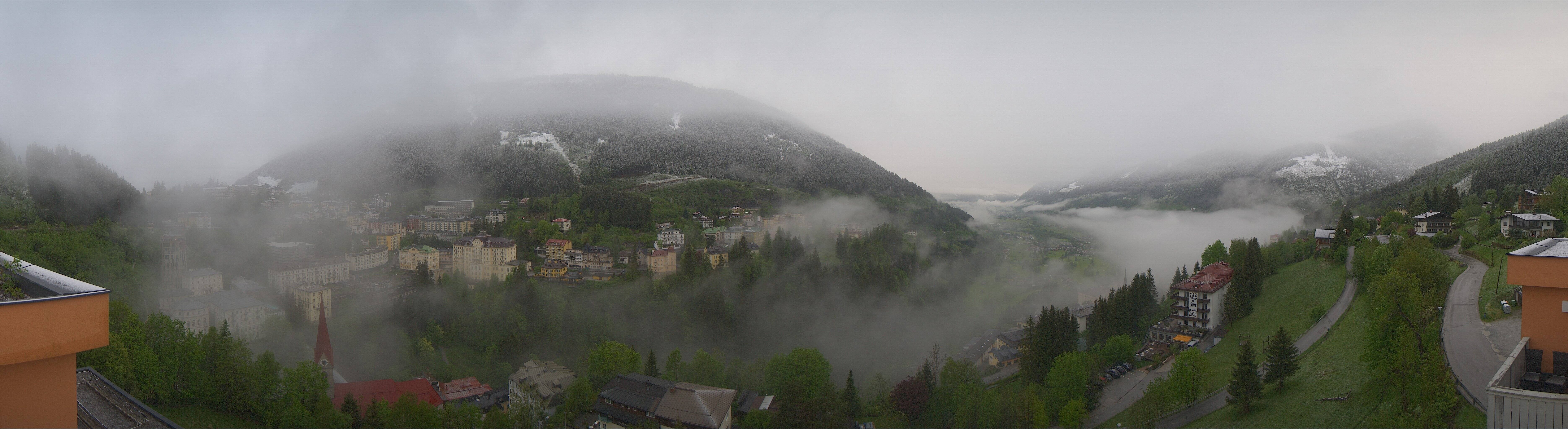 Archived image Webcam Hotel Schillerhof in Bad Gastein