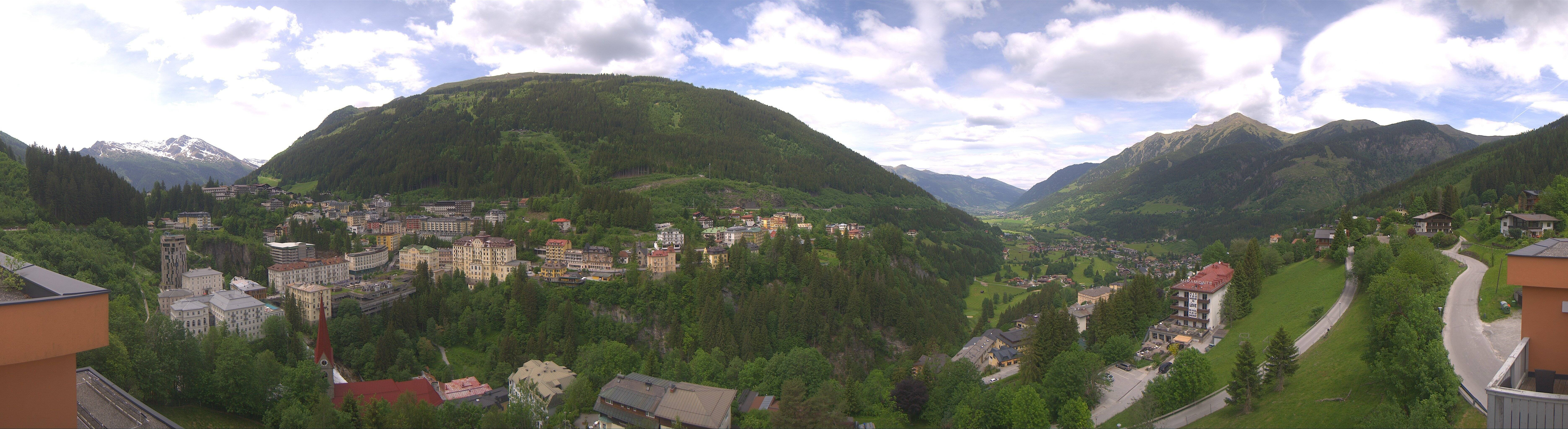 Archived image Webcam Hotel Schillerhof in Bad Gastein