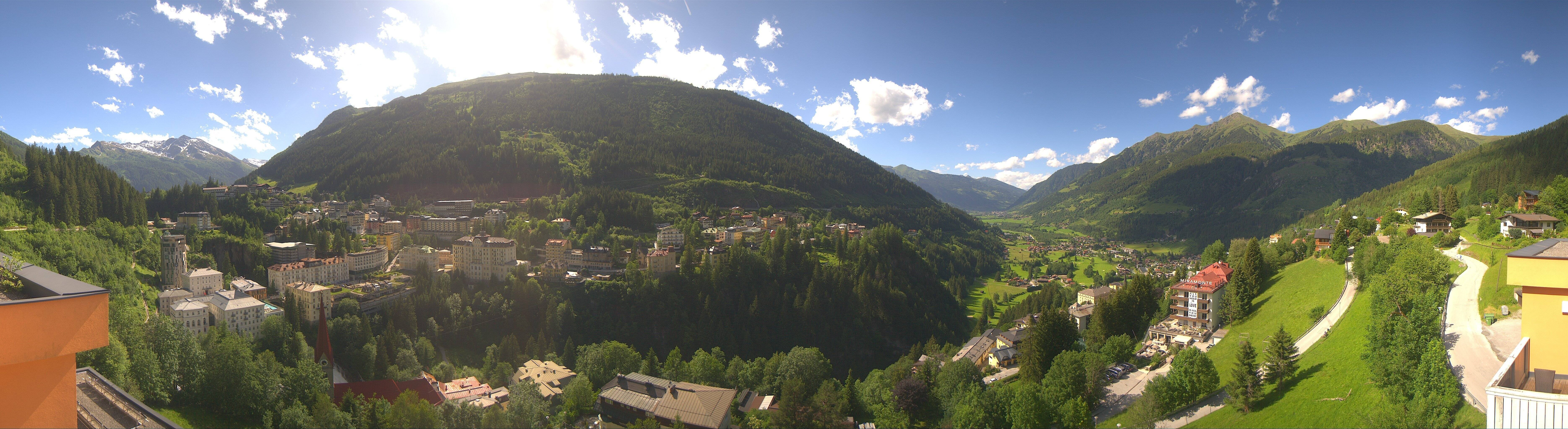 Archived image Webcam Hotel Schillerhof in Bad Gastein