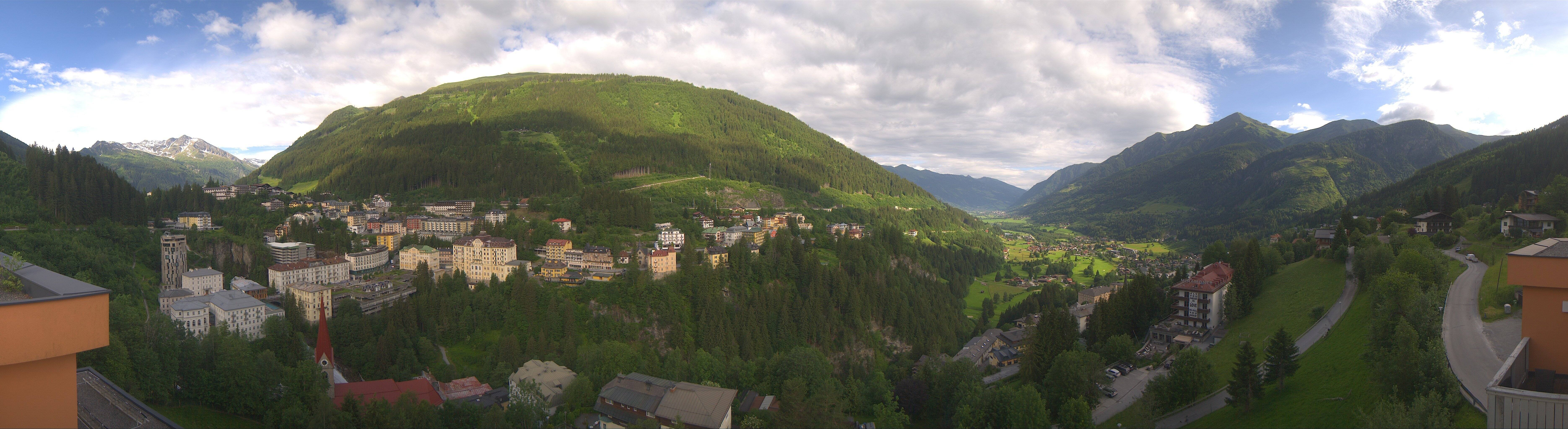 Archived image Webcam Hotel Schillerhof in Bad Gastein