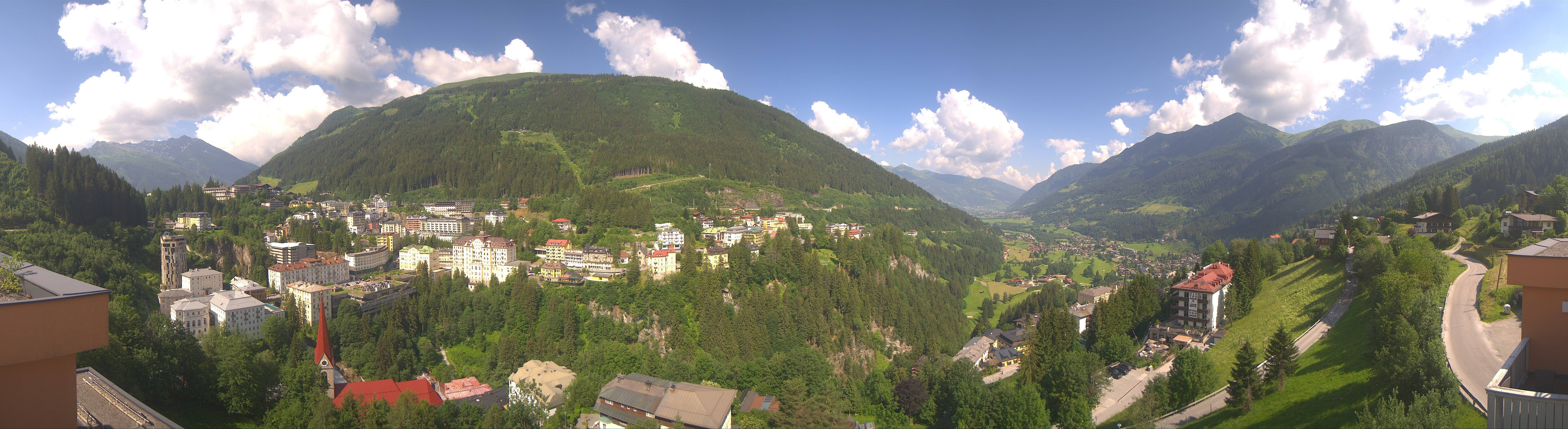 Archived image Webcam Hotel Schillerhof in Bad Gastein