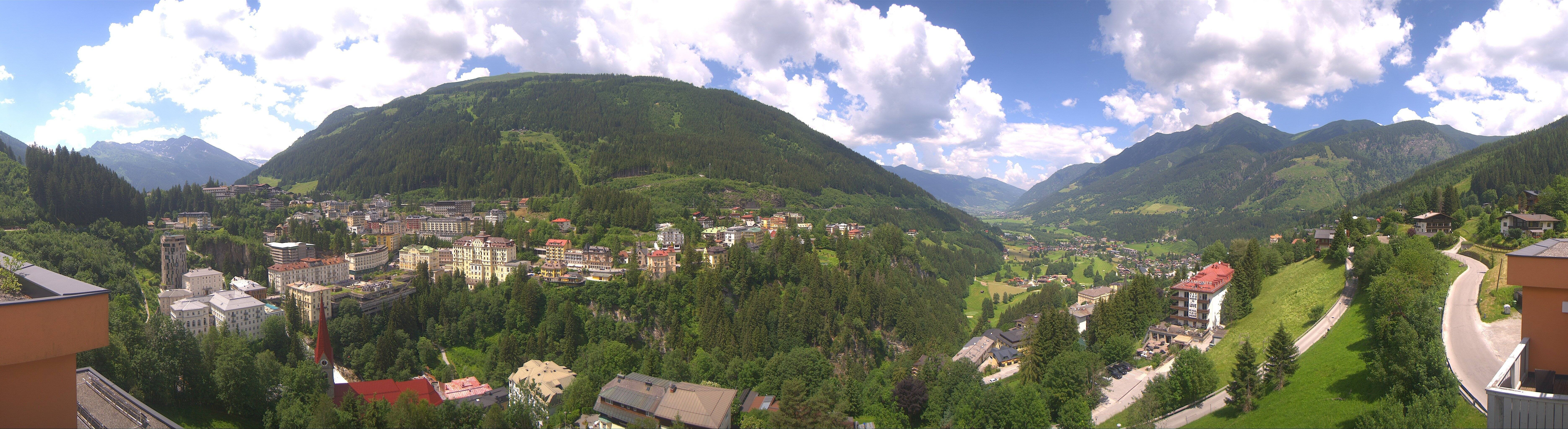 Archived image Webcam Hotel Schillerhof in Bad Gastein