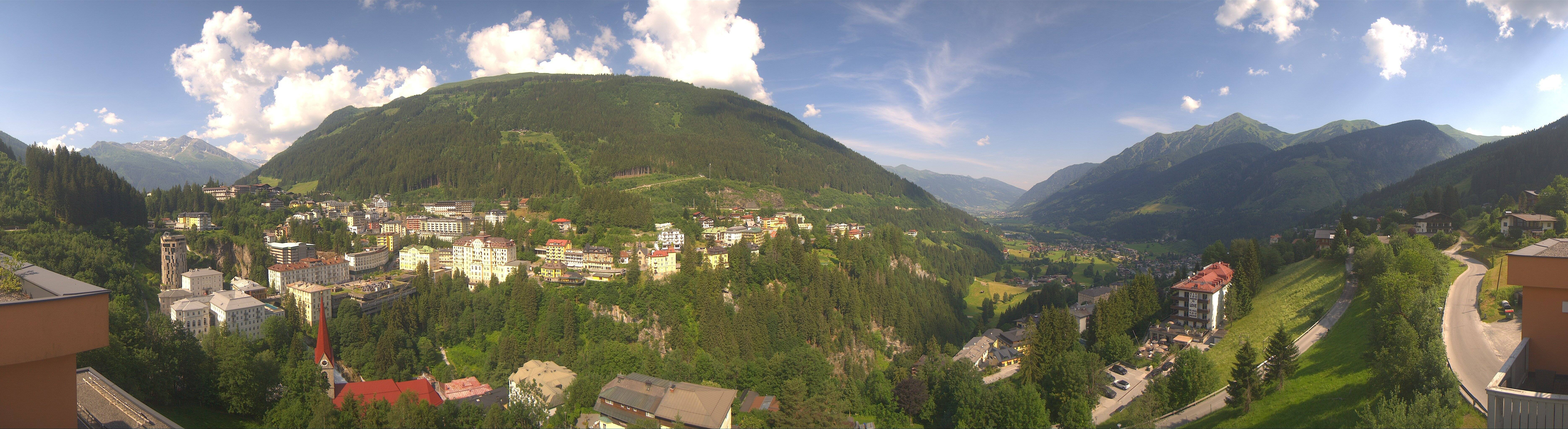 Archived image Webcam Hotel Schillerhof in Bad Gastein