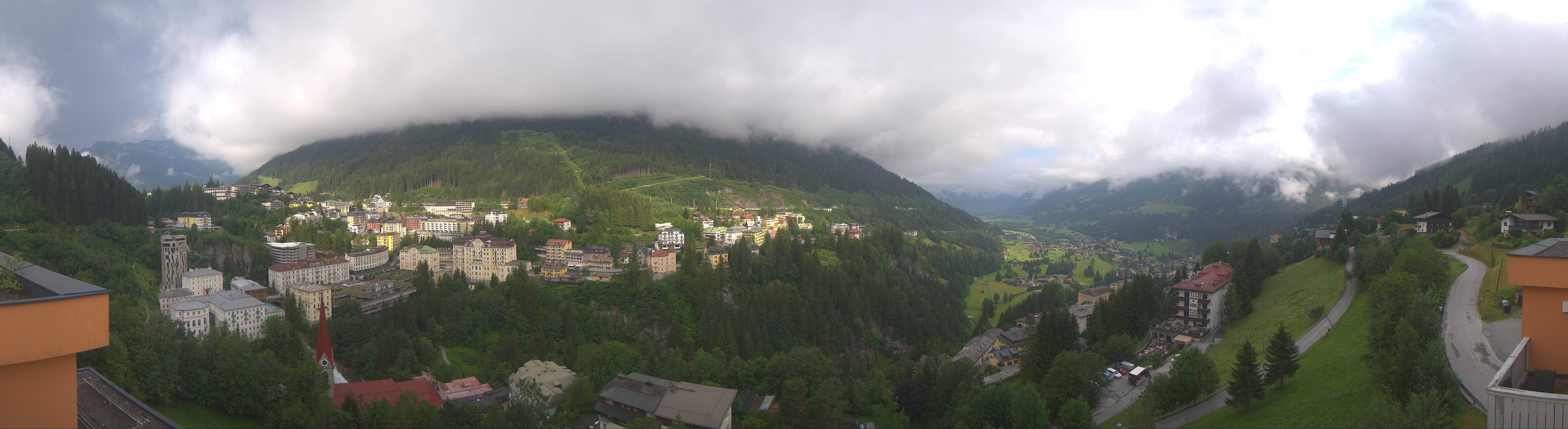 Archived image Webcam Hotel Schillerhof in Bad Gastein