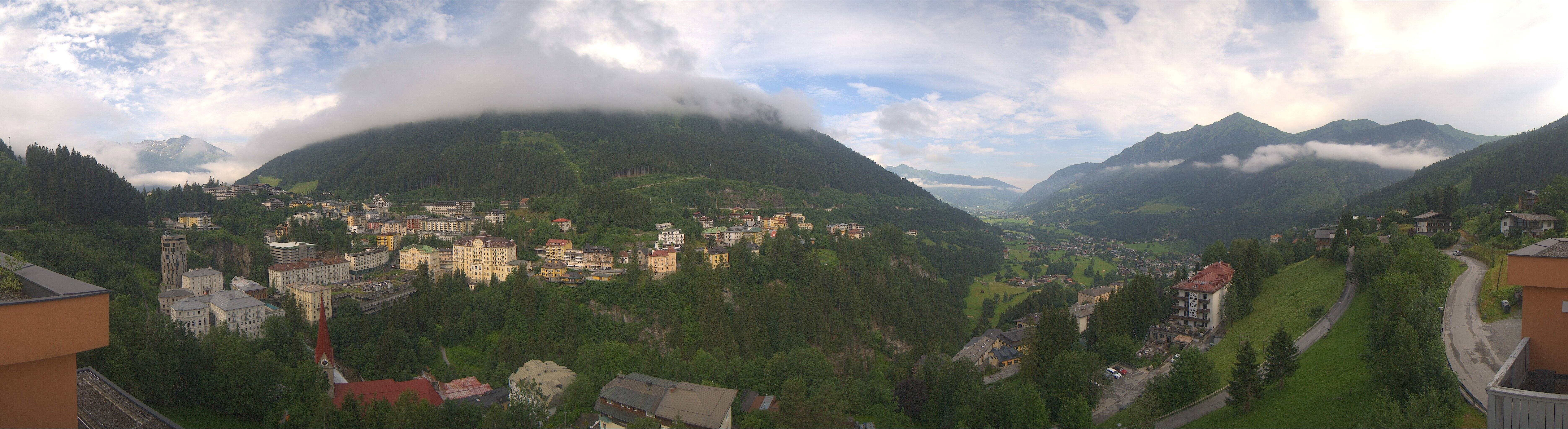 Archived image Webcam Hotel Schillerhof in Bad Gastein
