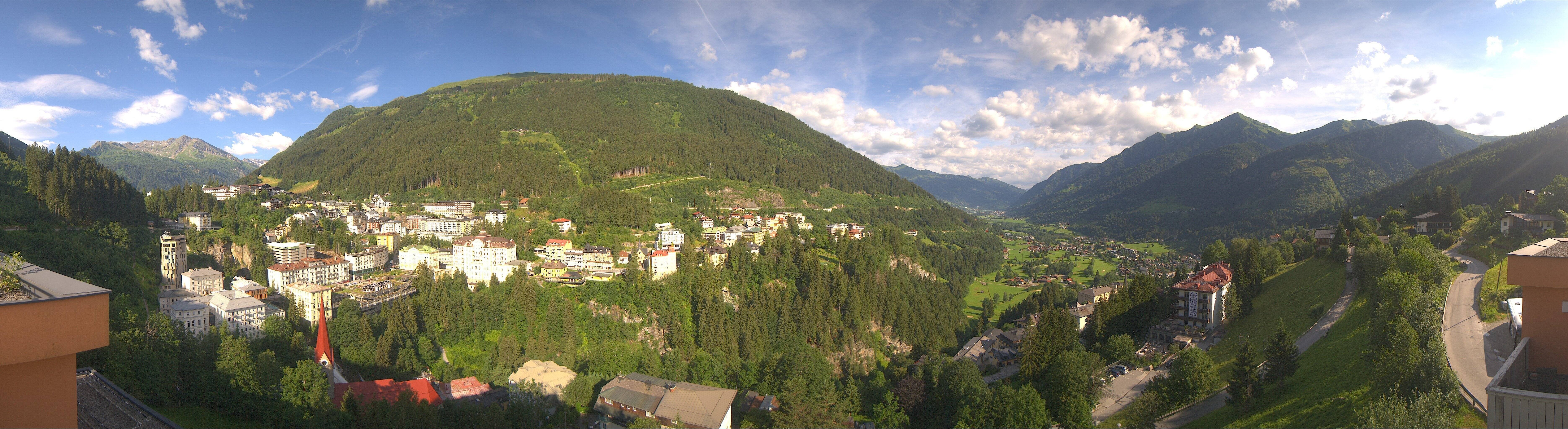 Archived image Webcam Hotel Schillerhof in Bad Gastein