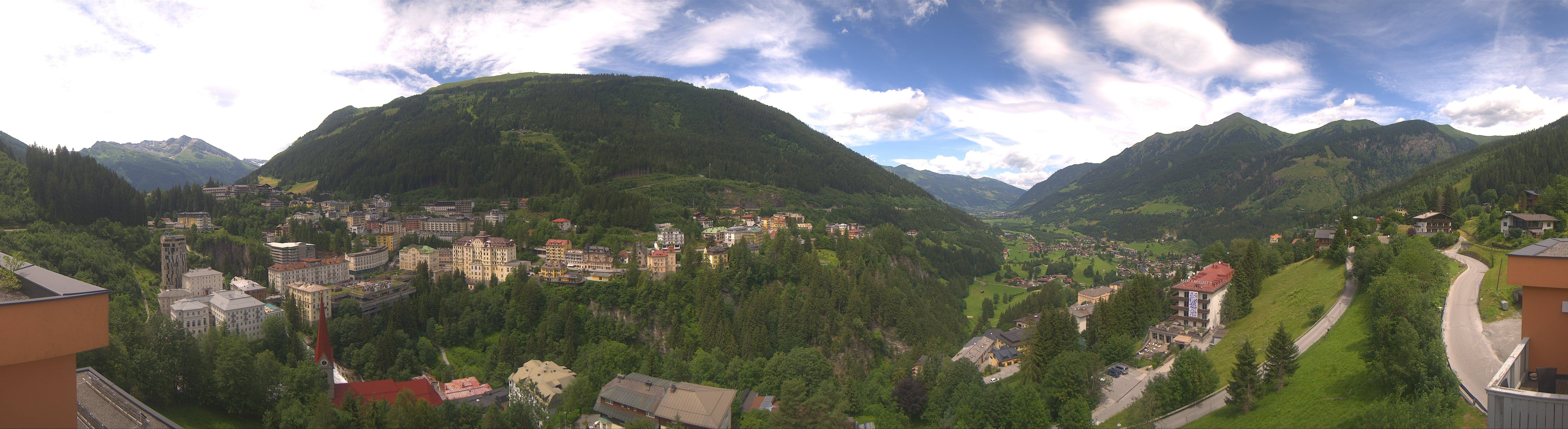 Archived image Webcam Hotel Schillerhof in Bad Gastein