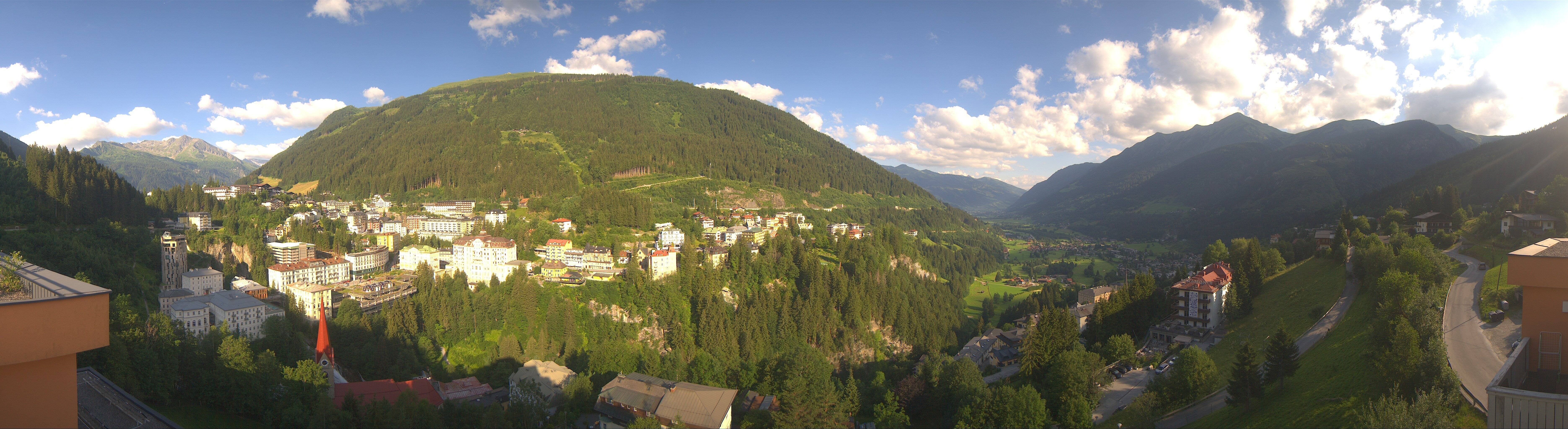 Archived image Webcam Hotel Schillerhof in Bad Gastein