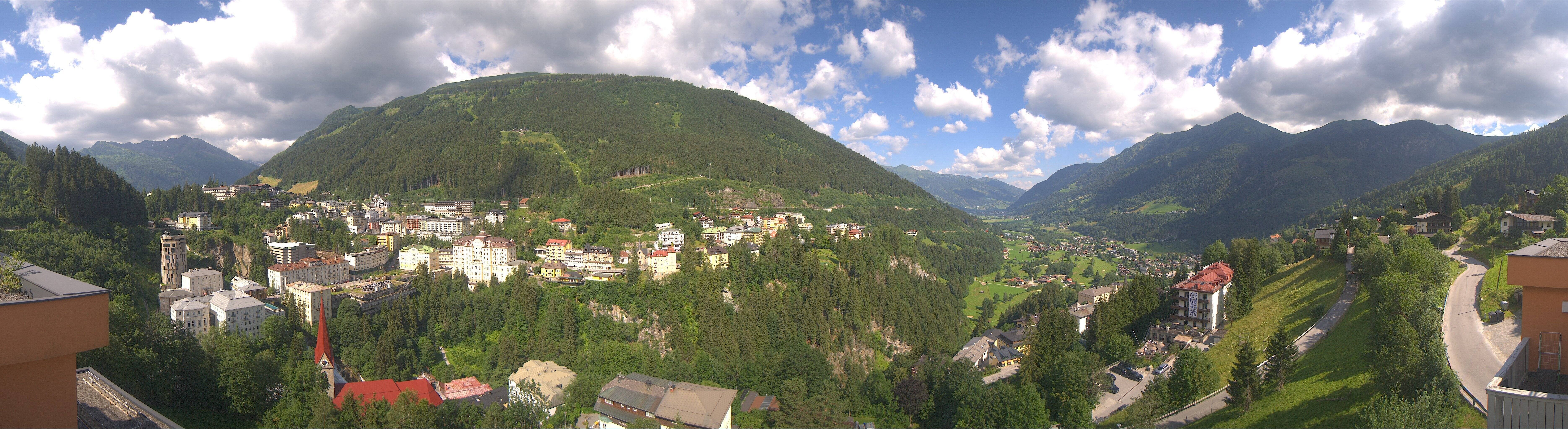 Archived image Webcam Hotel Schillerhof in Bad Gastein
