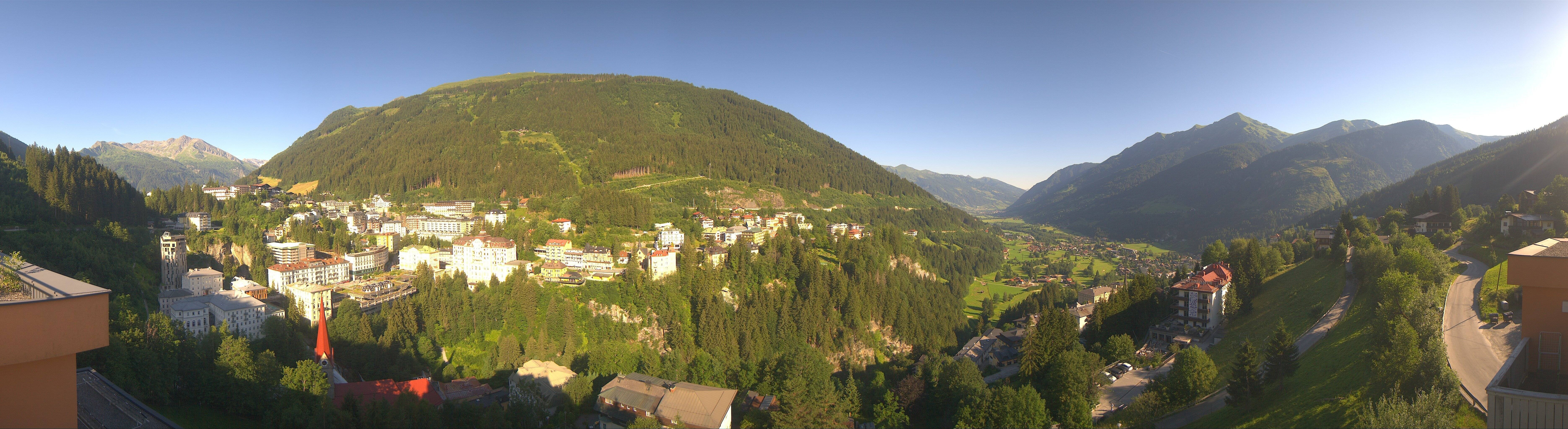 Archived image Webcam Hotel Schillerhof in Bad Gastein