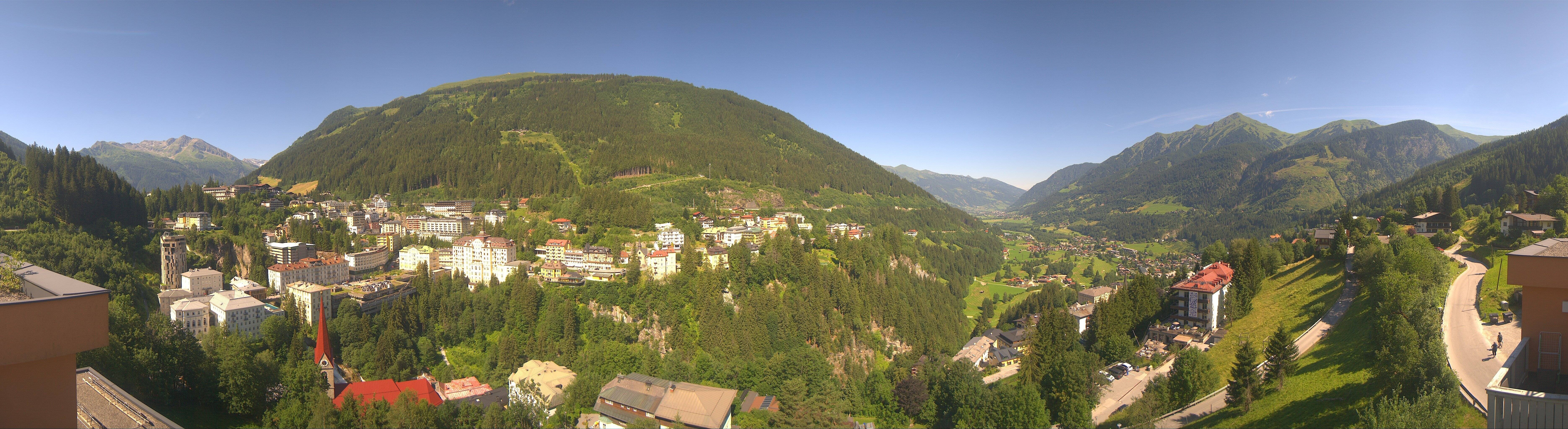 Archived image Webcam Hotel Schillerhof in Bad Gastein