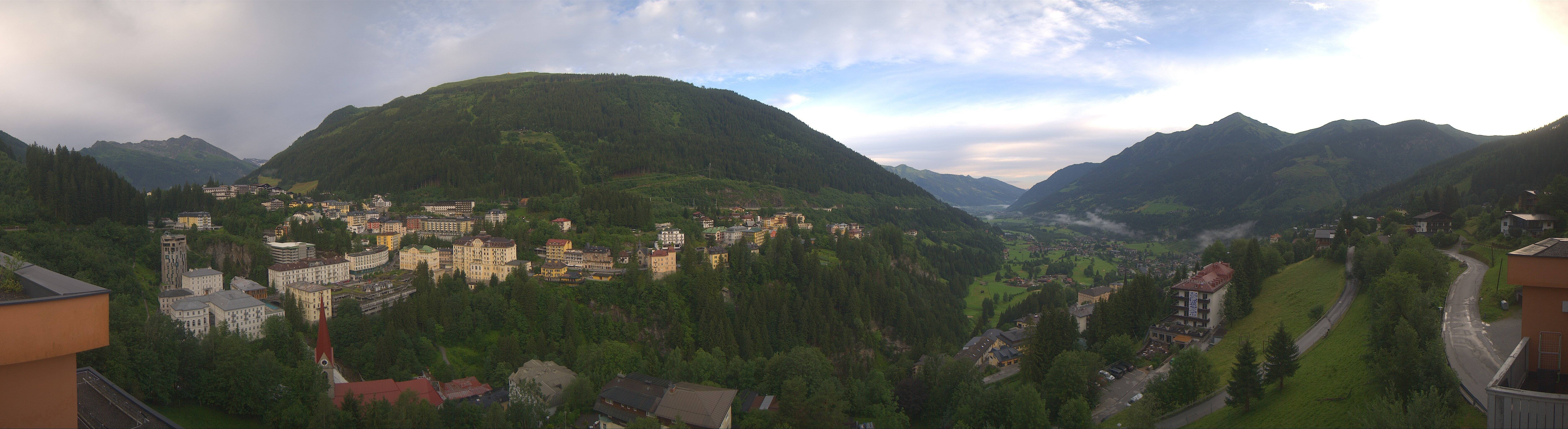 Archived image Webcam Hotel Schillerhof in Bad Gastein