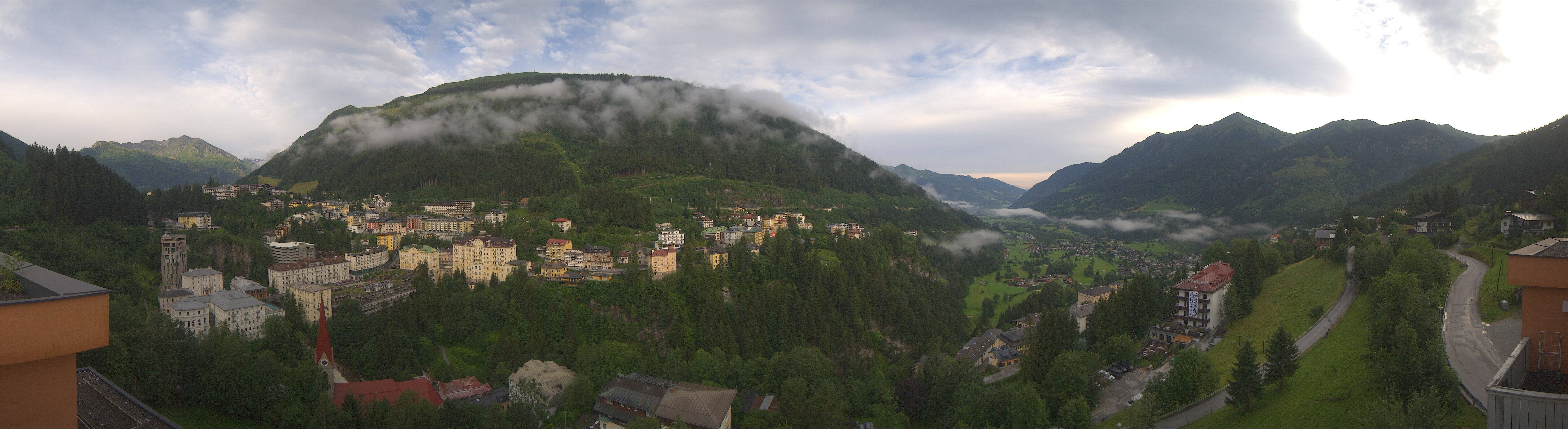 Archived image Webcam Hotel Schillerhof in Bad Gastein