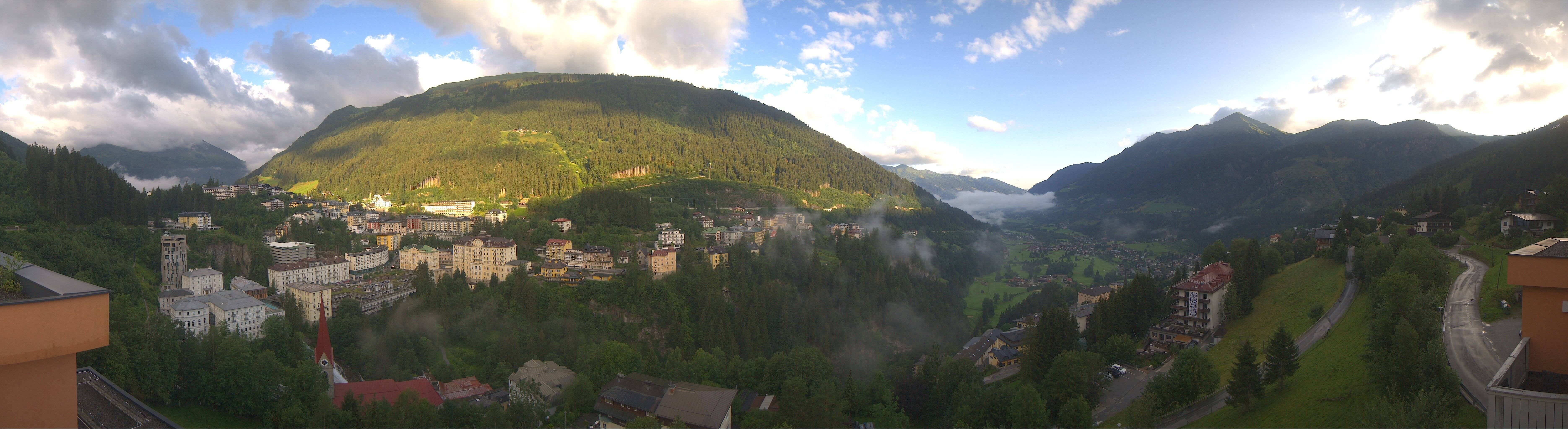 Archived image Webcam Hotel Schillerhof in Bad Gastein