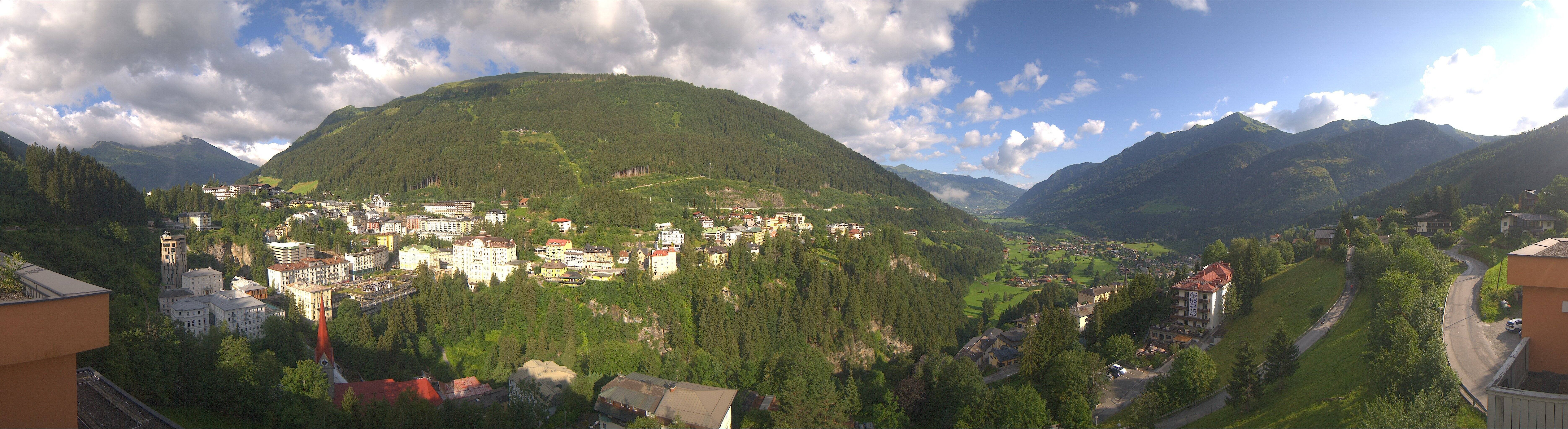 Archived image Webcam Hotel Schillerhof in Bad Gastein