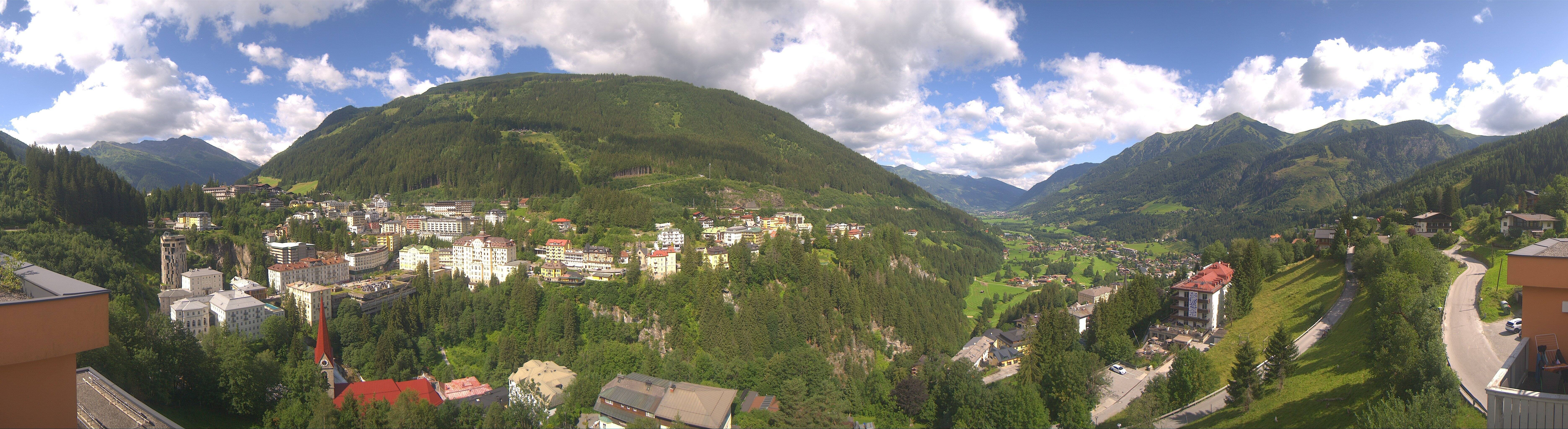 Archived image Webcam Hotel Schillerhof in Bad Gastein
