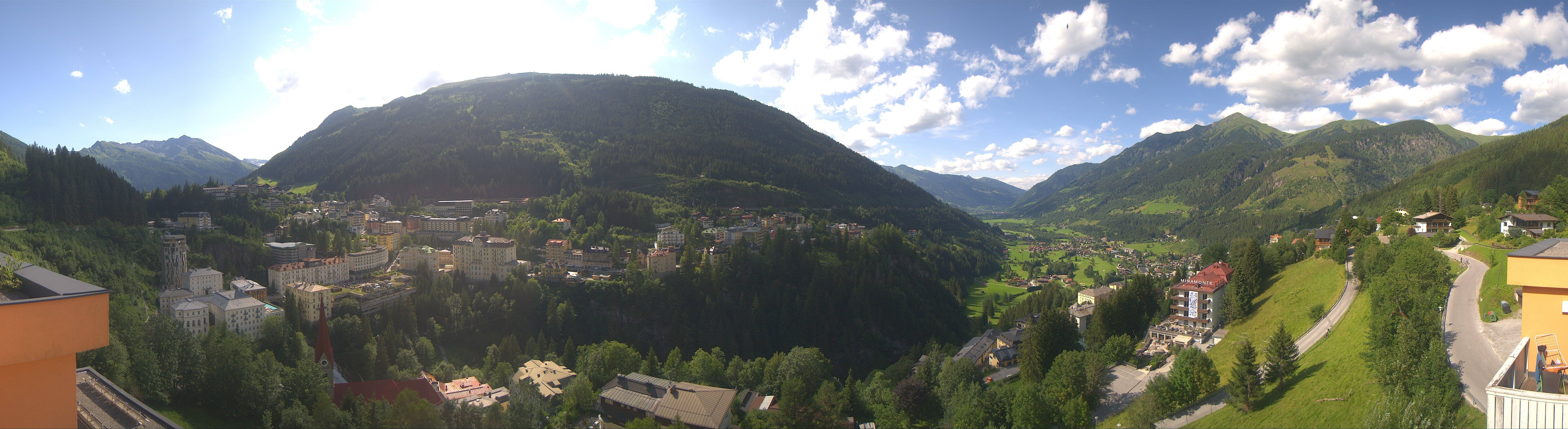 Archived image Webcam Hotel Schillerhof in Bad Gastein