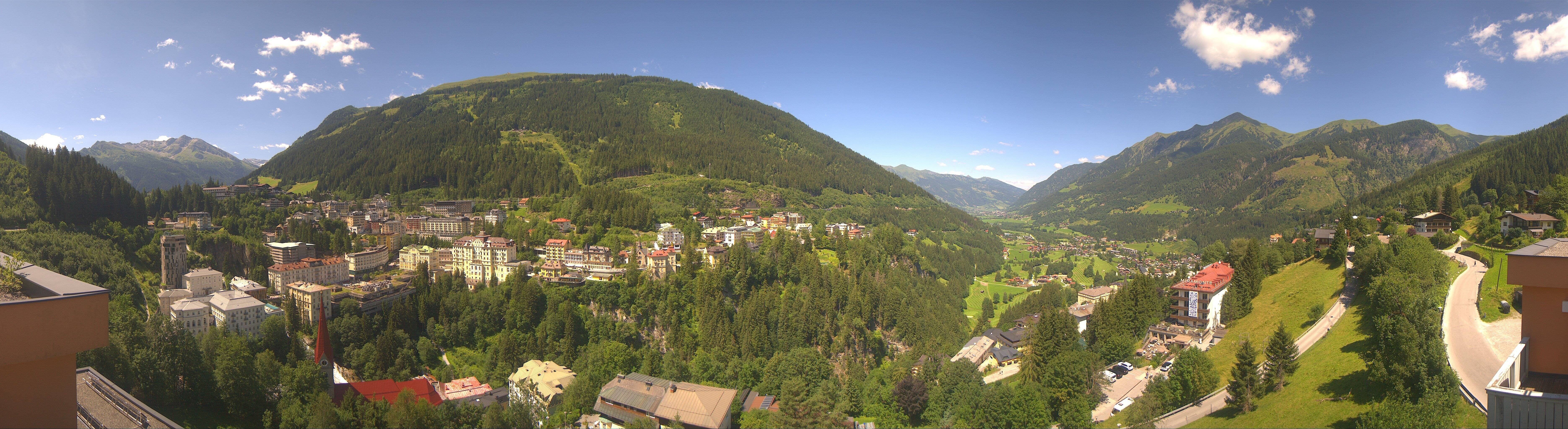 Archived image Webcam Hotel Schillerhof in Bad Gastein