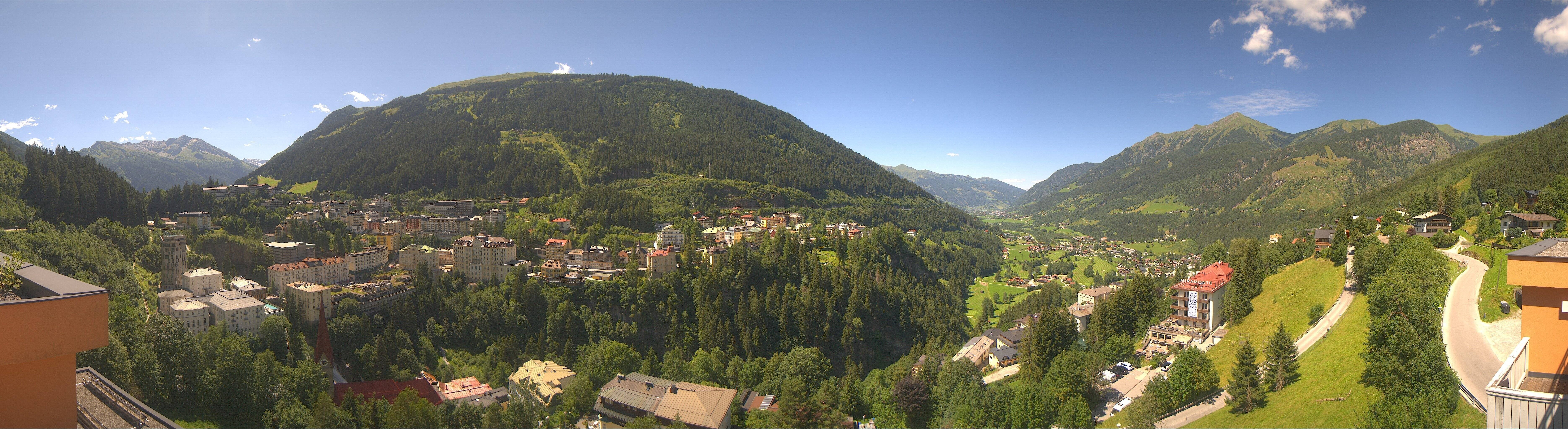Archived image Webcam Hotel Schillerhof in Bad Gastein