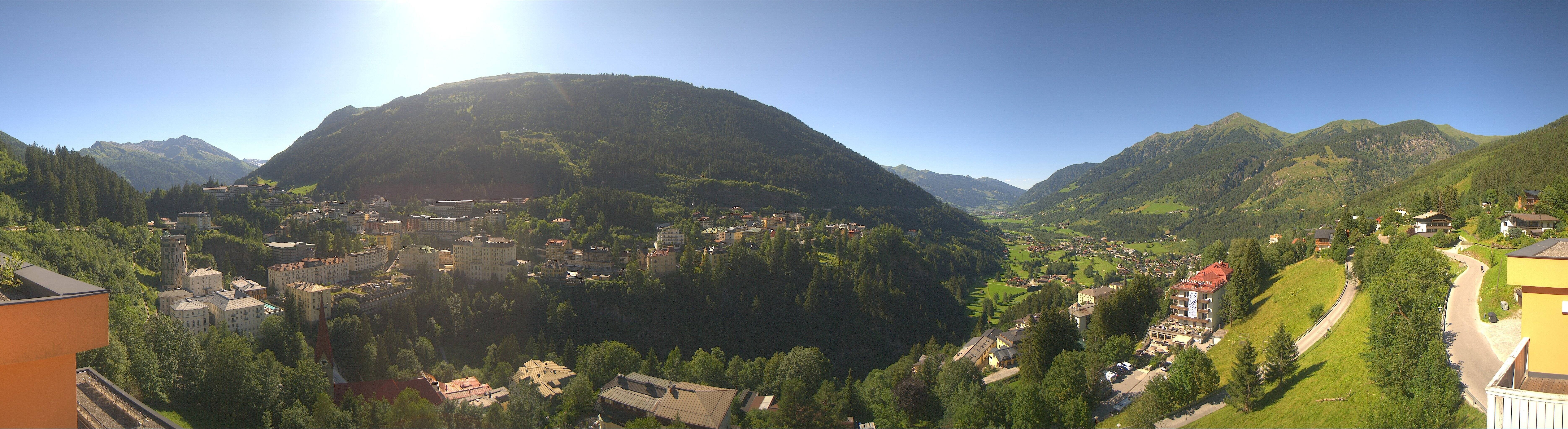 Archived image Webcam Hotel Schillerhof in Bad Gastein