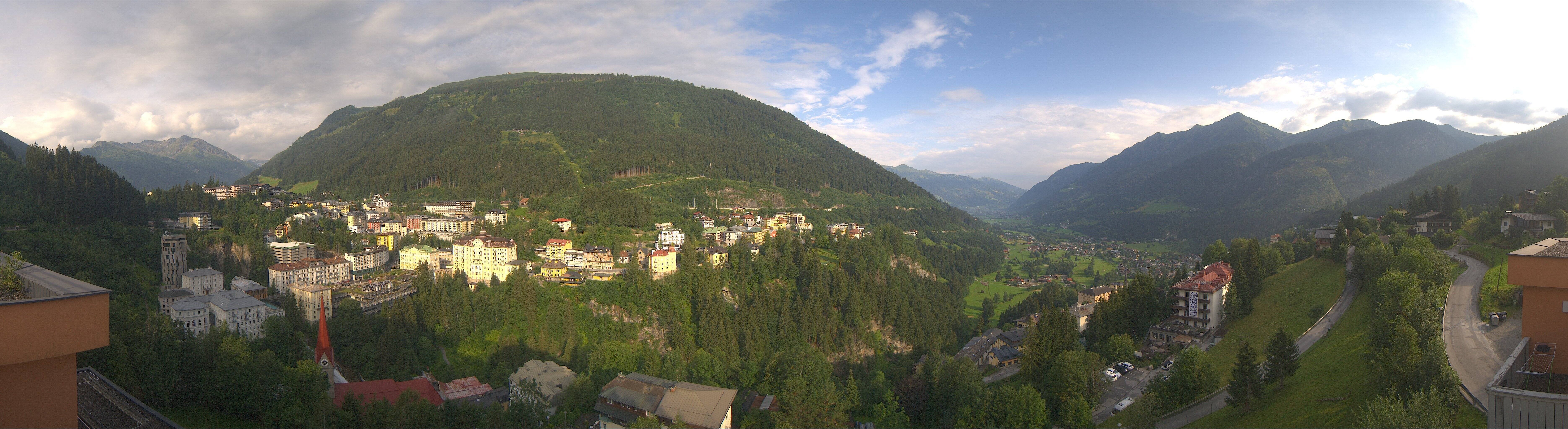 Archived image Webcam Hotel Schillerhof in Bad Gastein