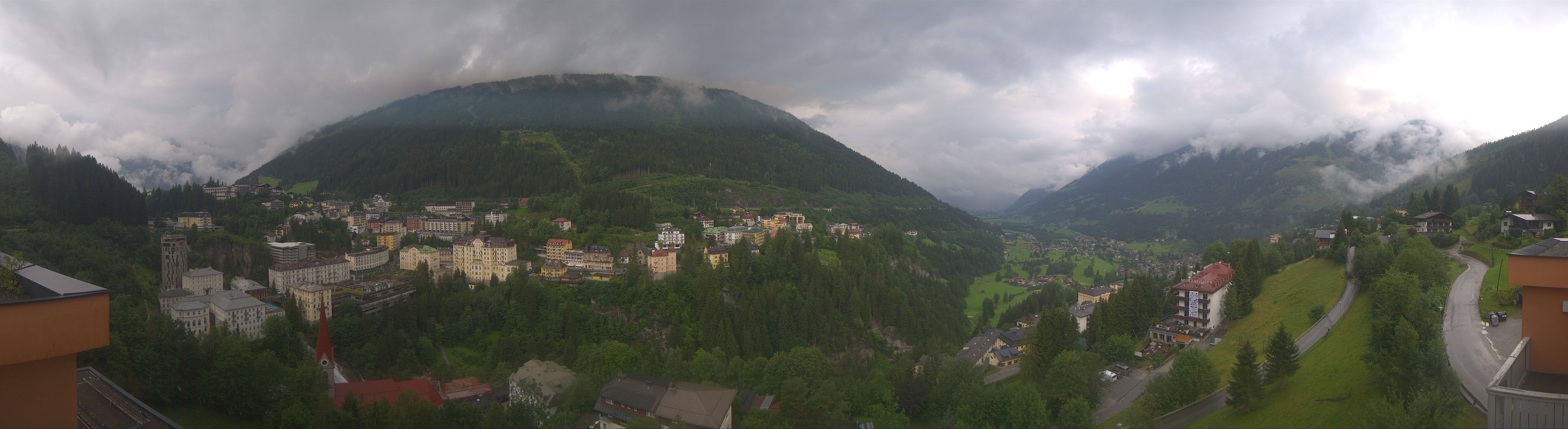 Archived image Webcam Hotel Schillerhof in Bad Gastein