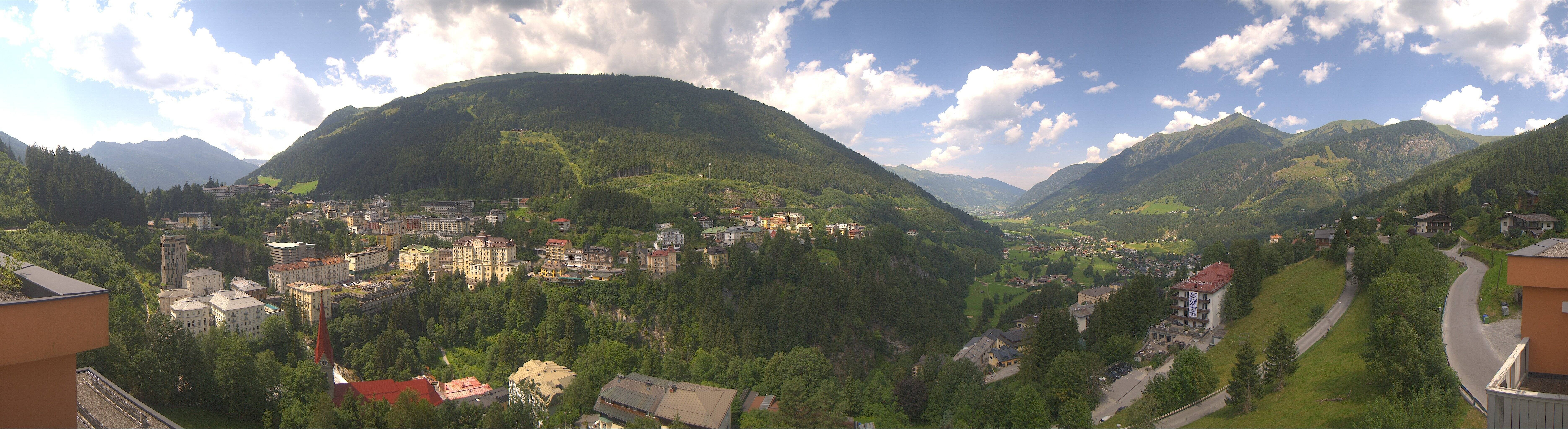 Archived image Webcam Hotel Schillerhof in Bad Gastein