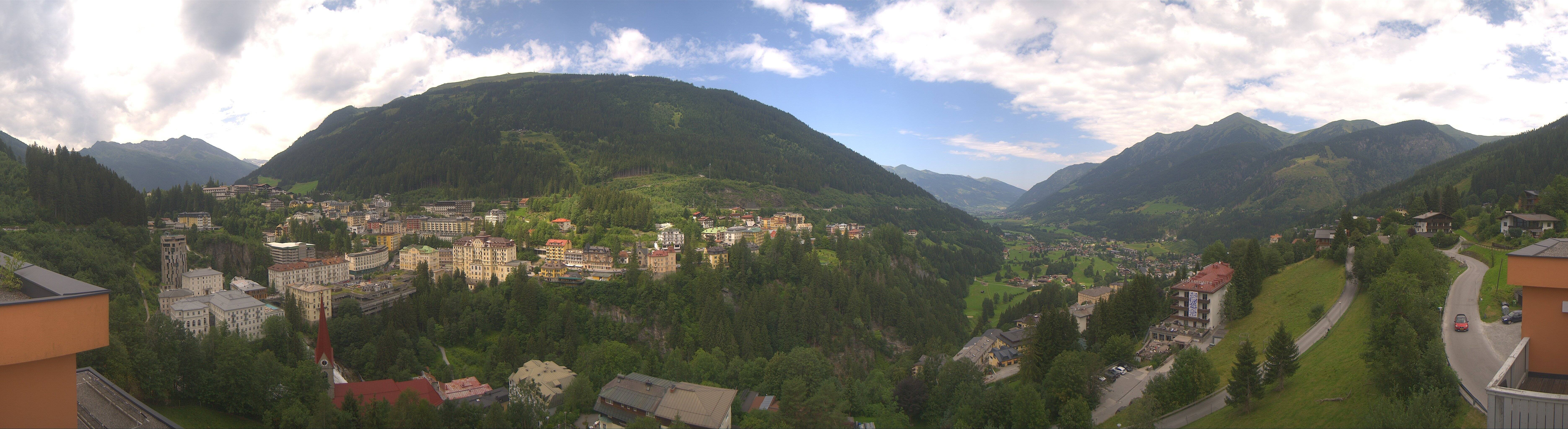 Archived image Webcam Hotel Schillerhof in Bad Gastein