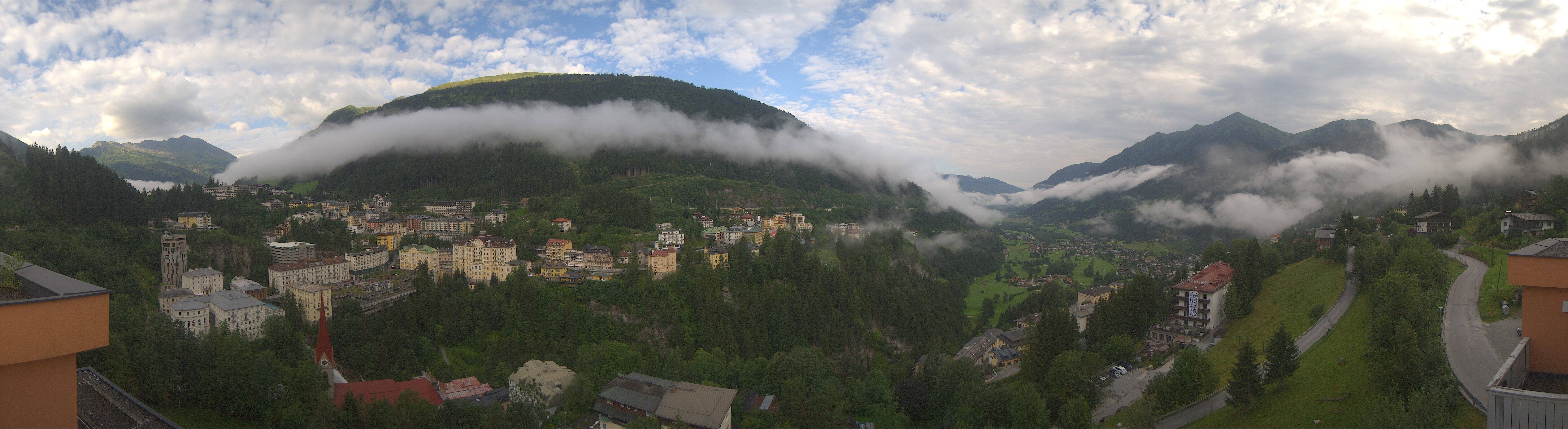 Archived image Webcam Hotel Schillerhof in Bad Gastein