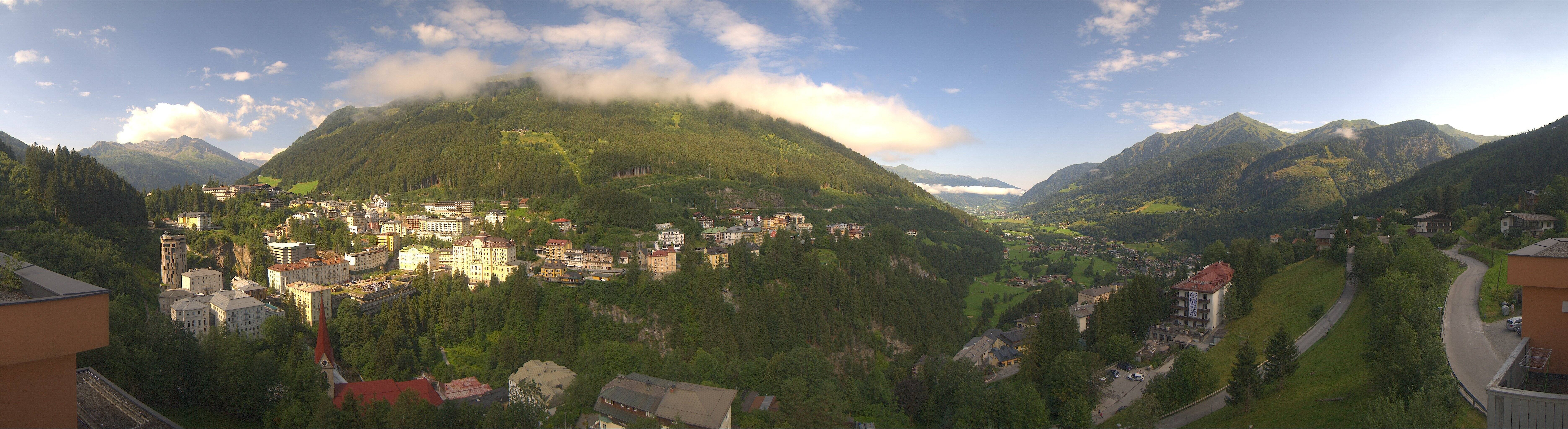Archived image Webcam Hotel Schillerhof in Bad Gastein