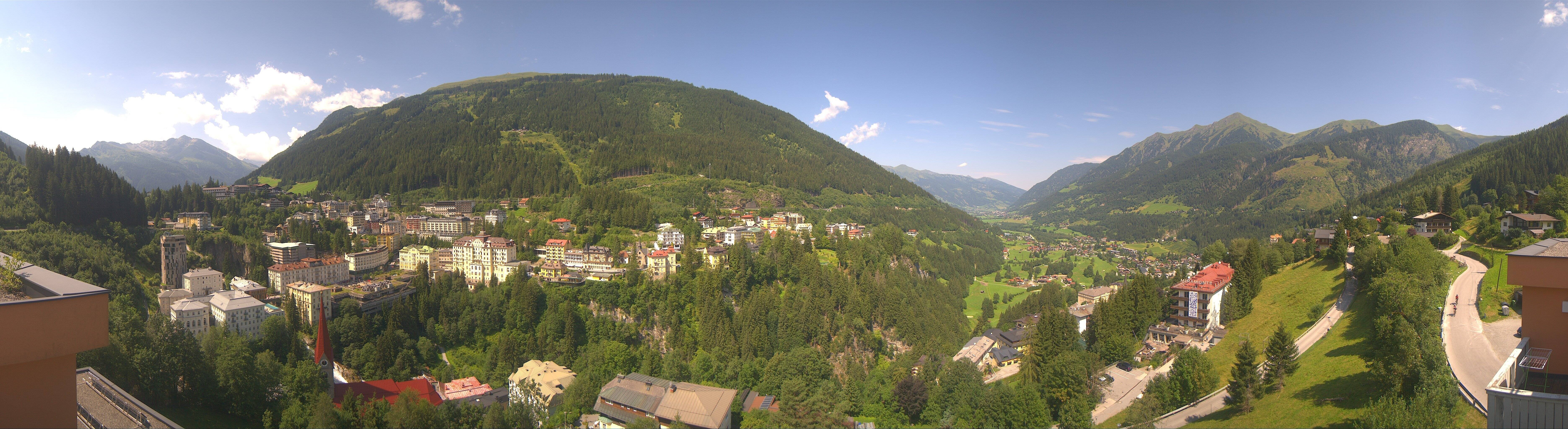 Archived image Webcam Hotel Schillerhof in Bad Gastein