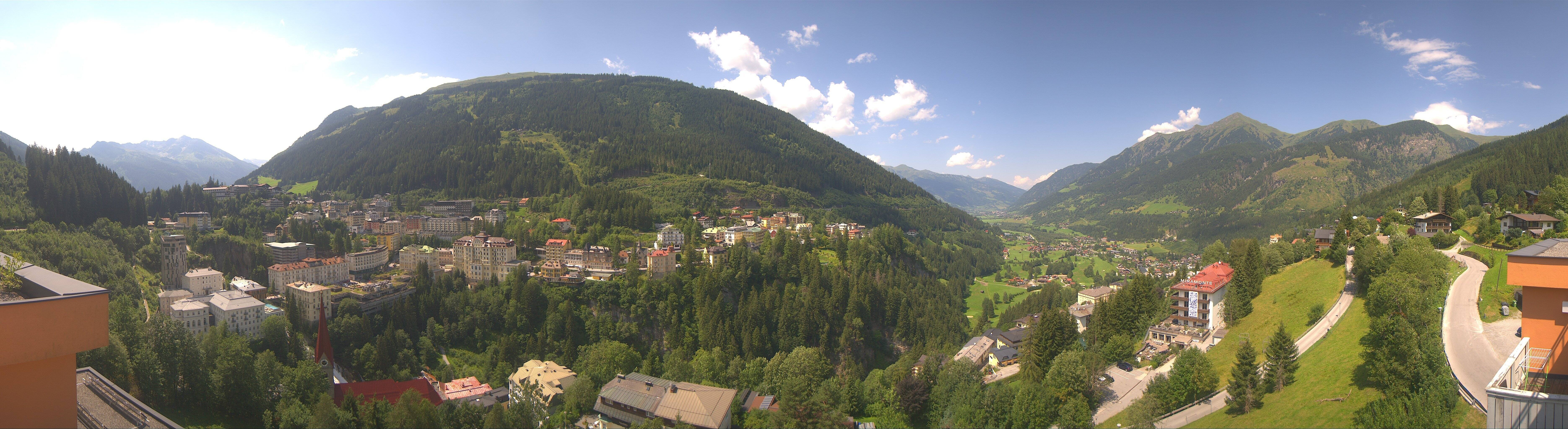 Archived image Webcam Hotel Schillerhof in Bad Gastein