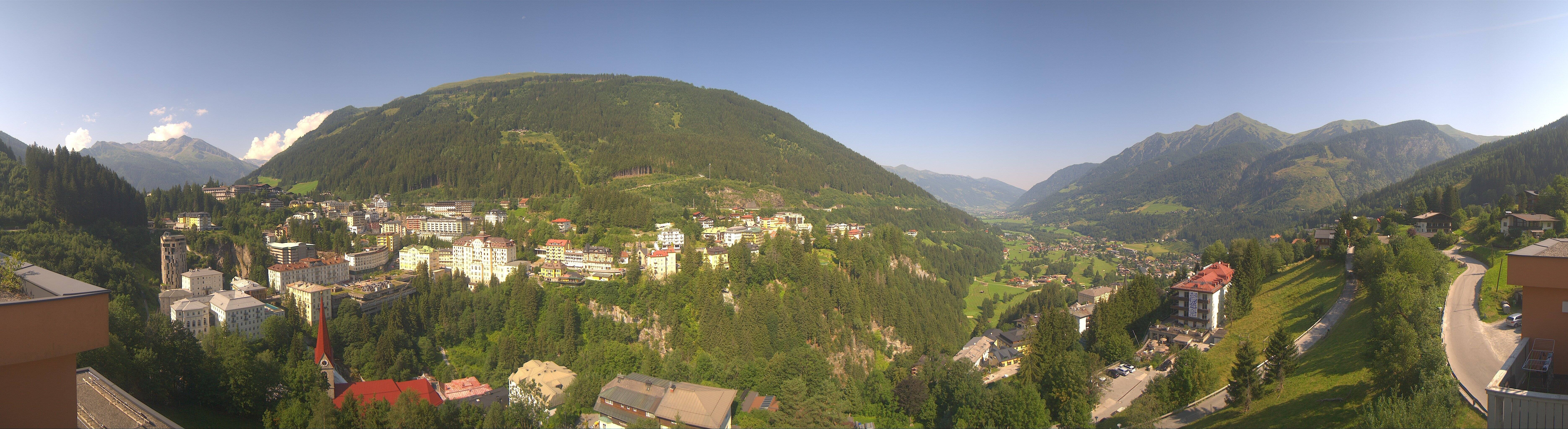 Archived image Webcam Hotel Schillerhof in Bad Gastein