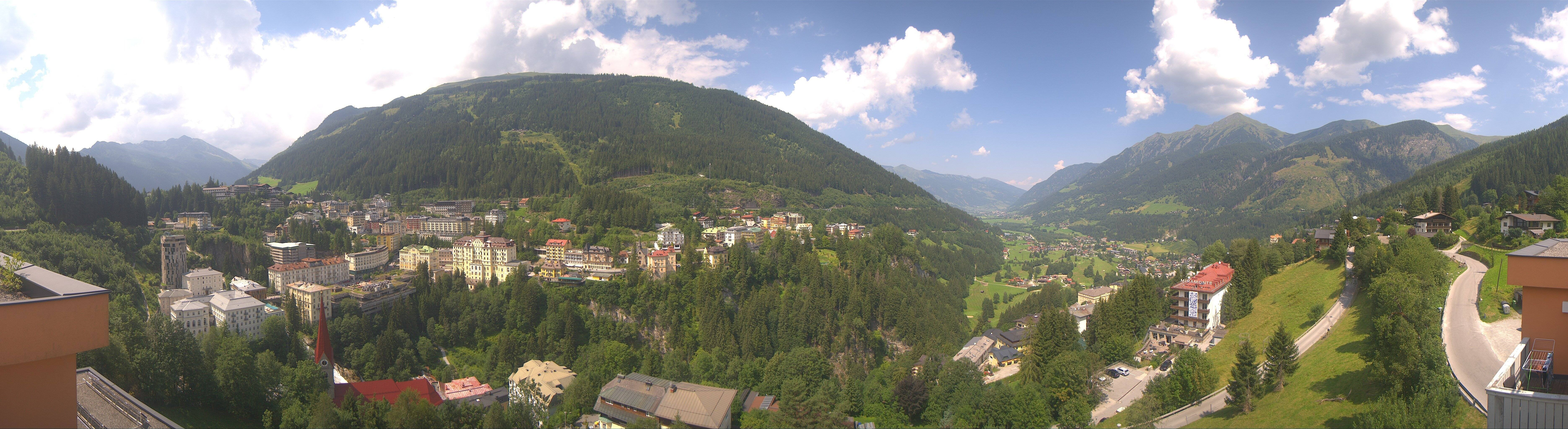 Archived image Webcam Hotel Schillerhof in Bad Gastein
