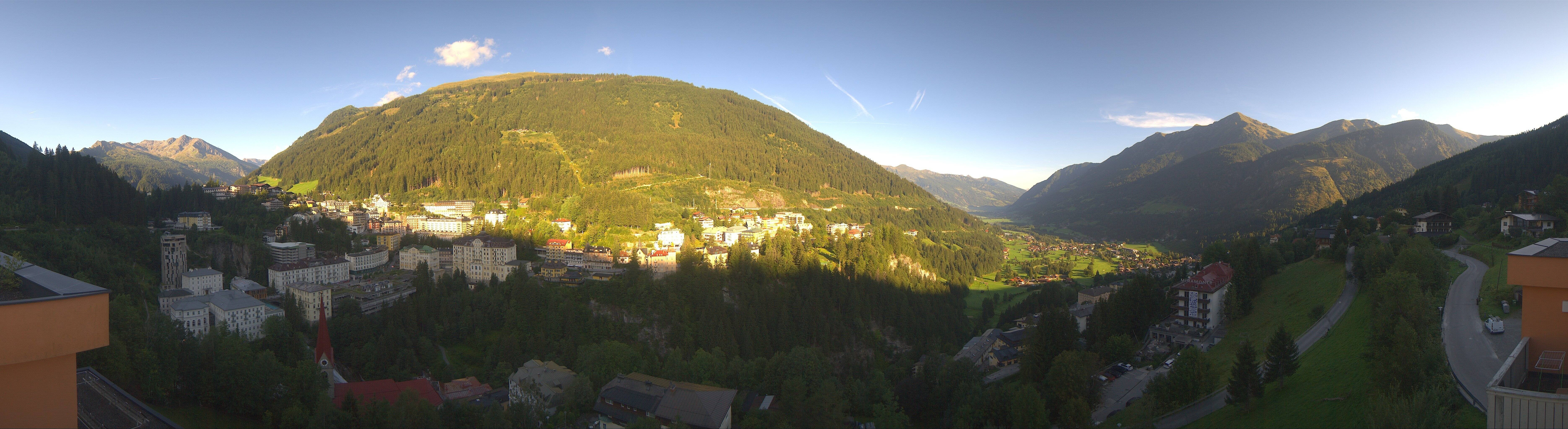 Archived image Webcam Hotel Schillerhof in Bad Gastein