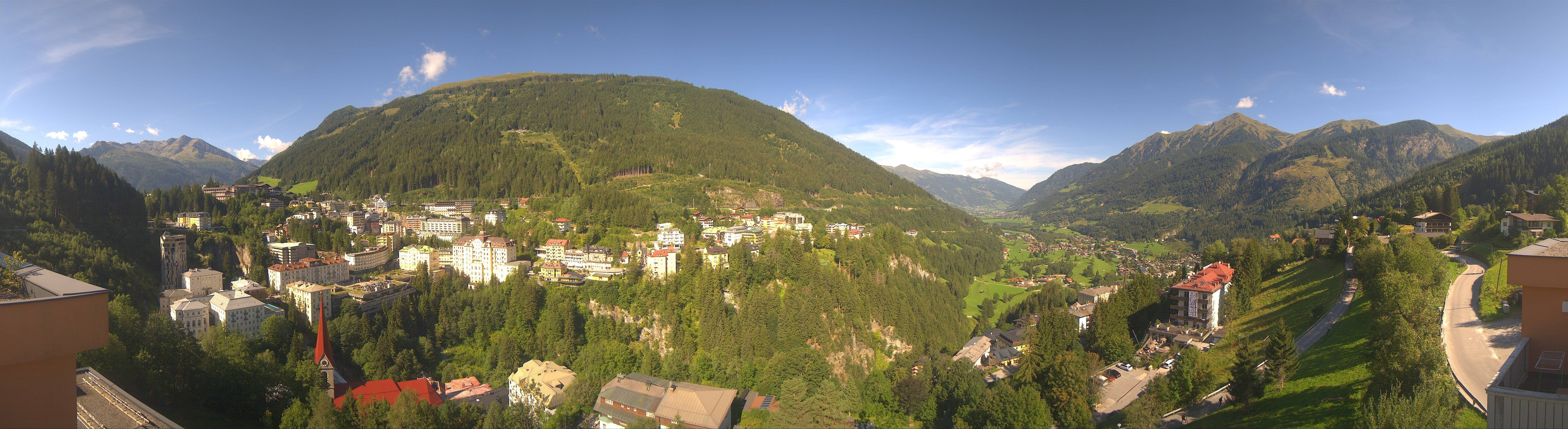 Archived image Webcam Hotel Schillerhof in Bad Gastein