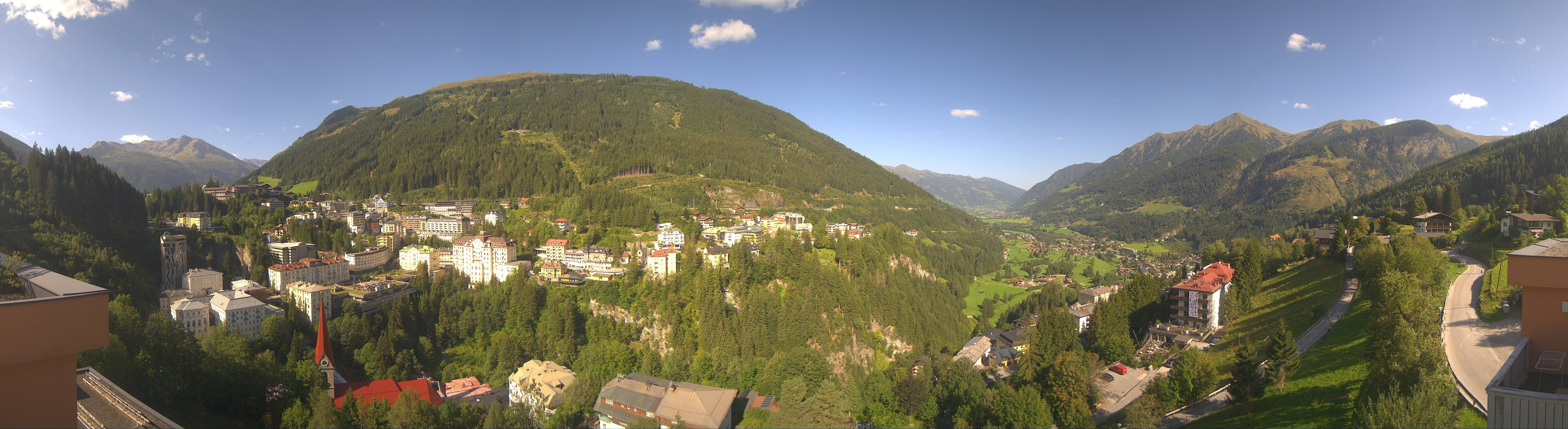 Archived image Webcam Hotel Schillerhof in Bad Gastein