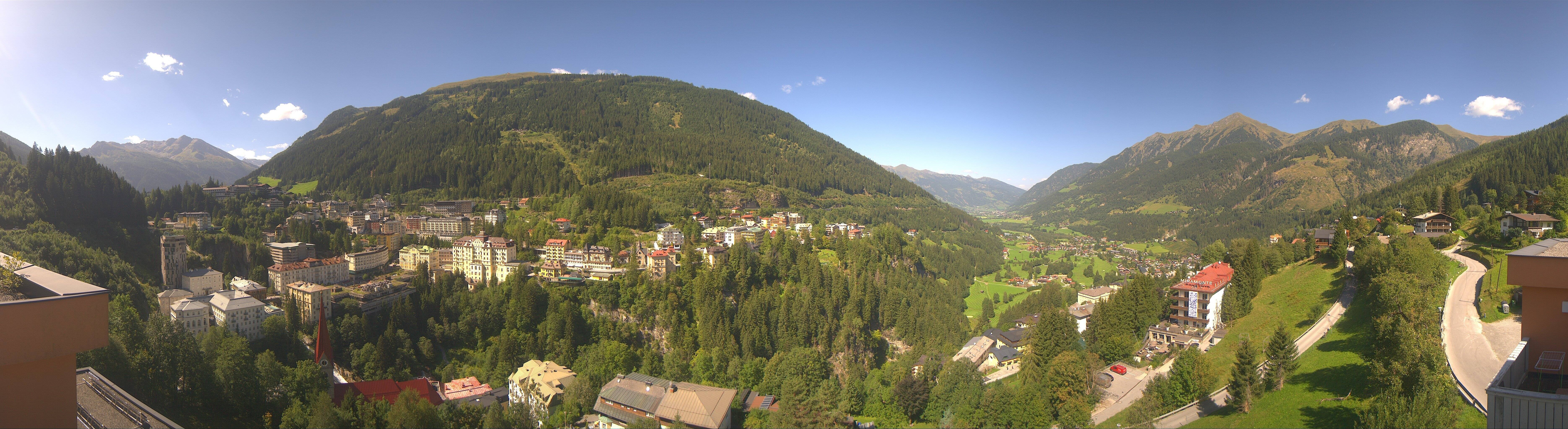 Archived image Webcam Hotel Schillerhof in Bad Gastein