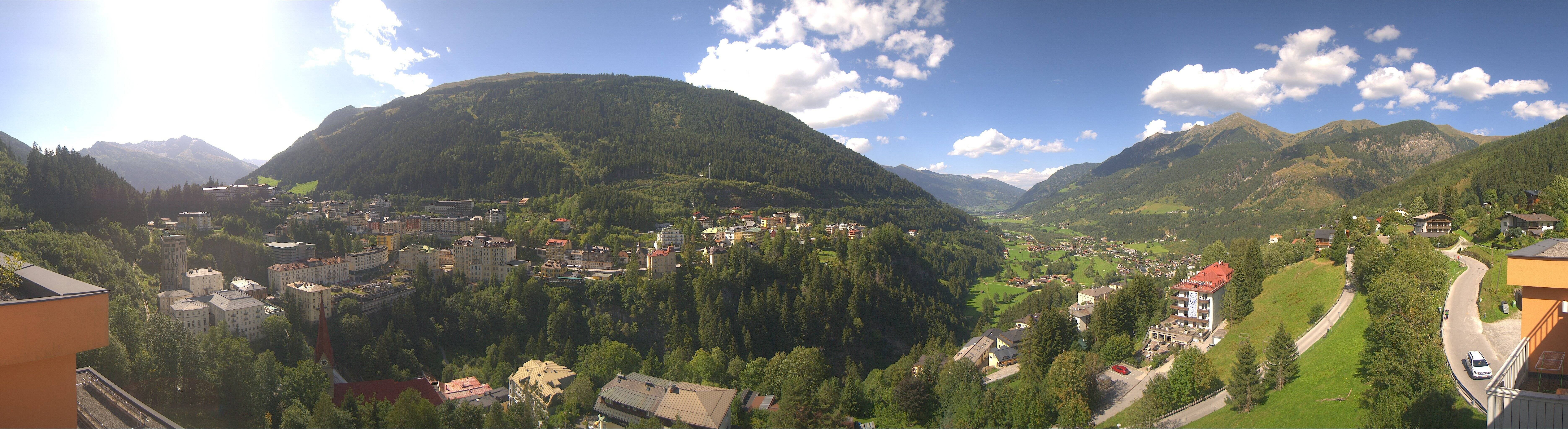 Archived image Webcam Hotel Schillerhof in Bad Gastein