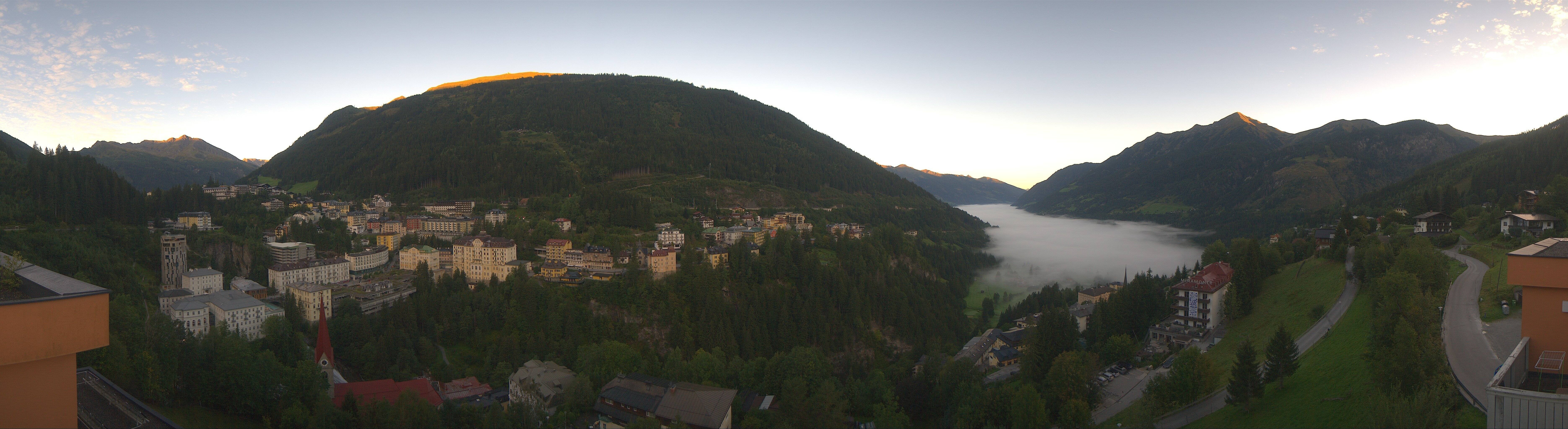 Archived image Webcam Hotel Schillerhof in Bad Gastein
