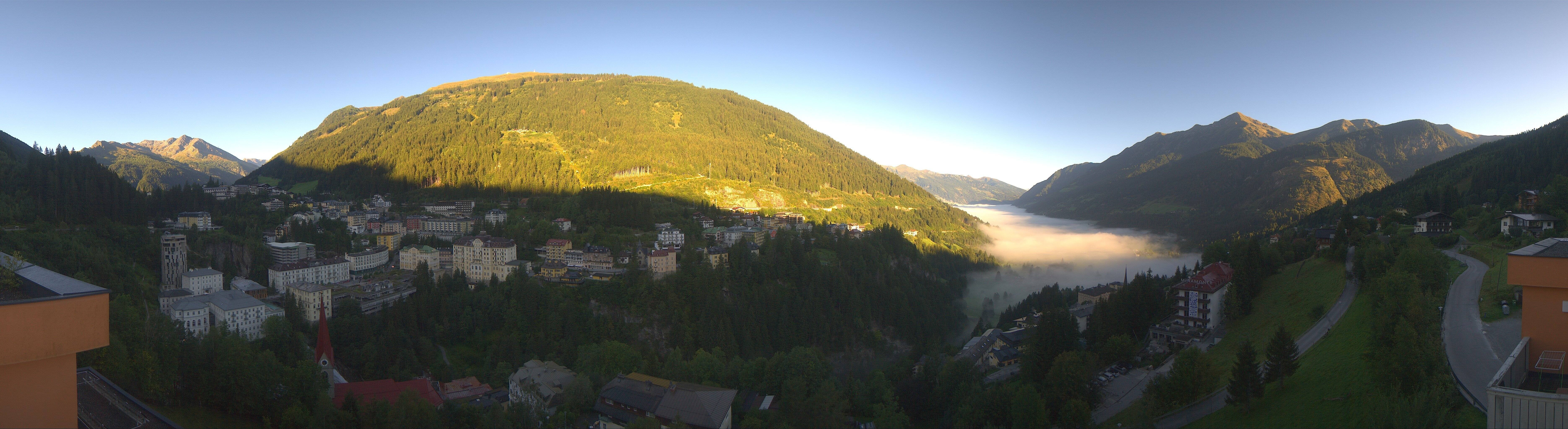 Archived image Webcam Hotel Schillerhof in Bad Gastein
