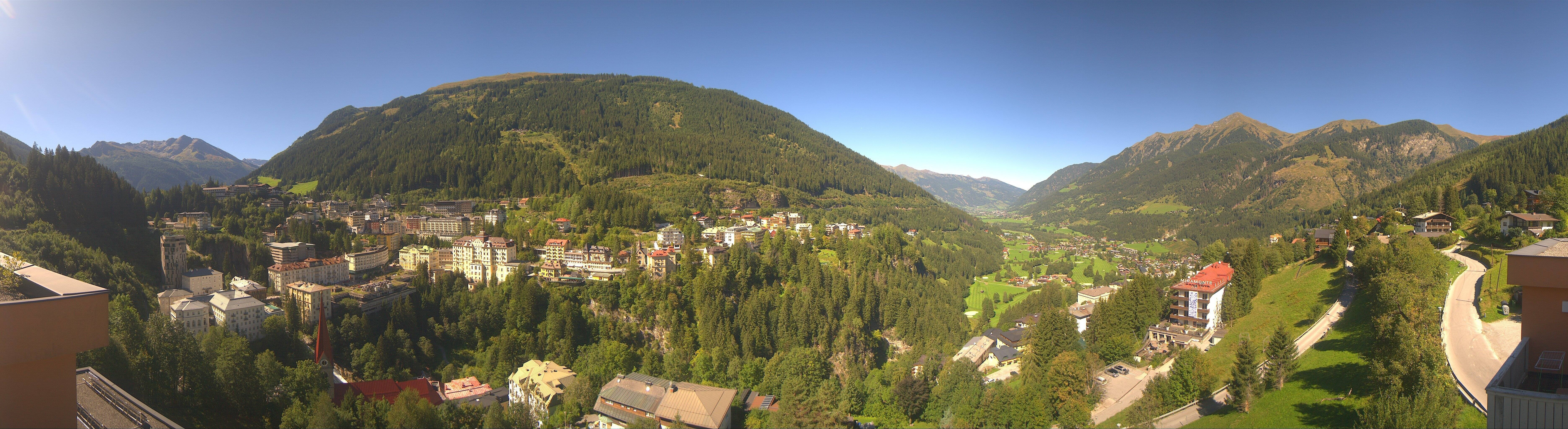 Archived image Webcam Hotel Schillerhof in Bad Gastein