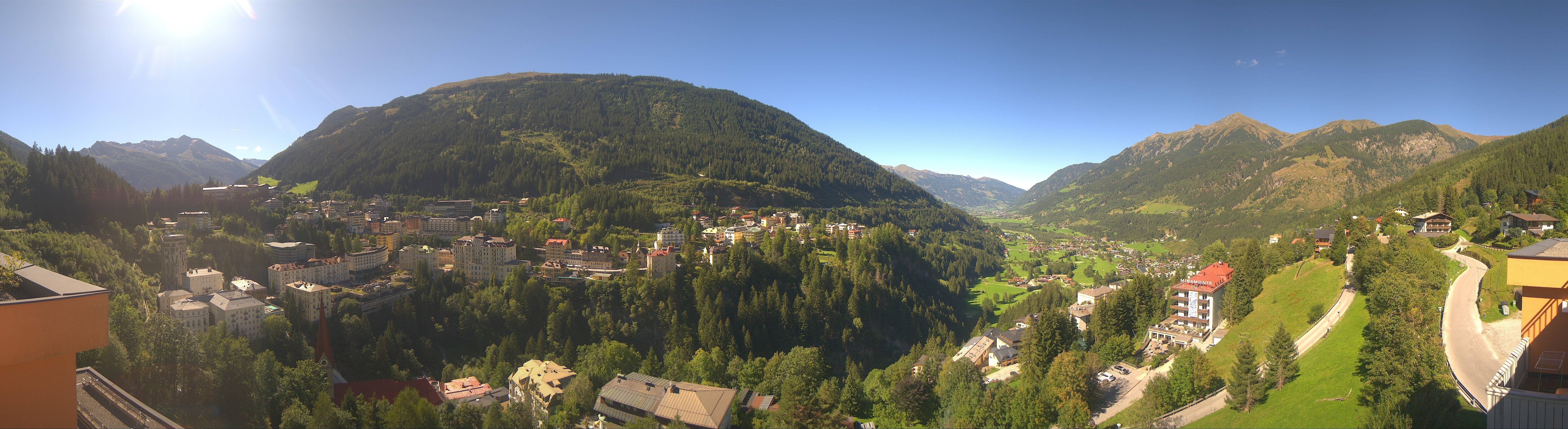 Archived image Webcam Hotel Schillerhof in Bad Gastein